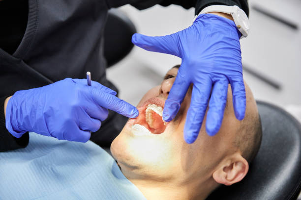 Best Emergency Dental Filling Replacement  in Ellenville, NY